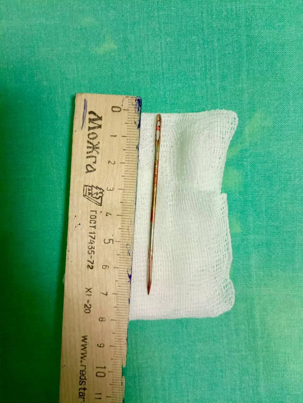 Врачи МОЦОМД в Люберцах спасли ребенка с 7-сантиметровой иглой в уретре